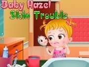 Juego Baby Hazel Skin Trouble Juego Baby Hazel Skin Trouble