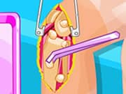 Juego Barbie Knee Surgery Juego Barbie Knee Surgery