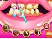 Juego Barbie va al Dentista Juego Barbie va al Dentista