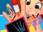 Juego Deni hand surgery Juego Deni hand surgery