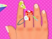 Juego Finger Surgery Juego Finger Surgery