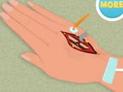 Juego Hand Surgery Juego Hand Surgery