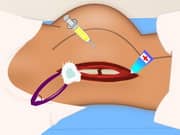 Juego Hip Surgery Juego Hip Surgery