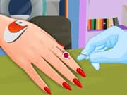 Juego Manicure After Injury Juego Manicure After Injury