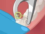 Juego Operate Now Dental Surgery Juego Operate Now Dental Surgery