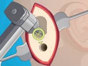 Juego Operate Now Ear Surgery Juego Operate Now Ear Surgery