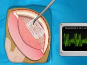 Juego Operate Now Epilepsy Surgery Juego Operate Now Epilepsy Surgery